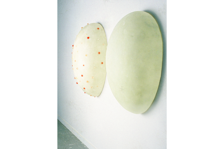 Skin Peel Acne, 1994